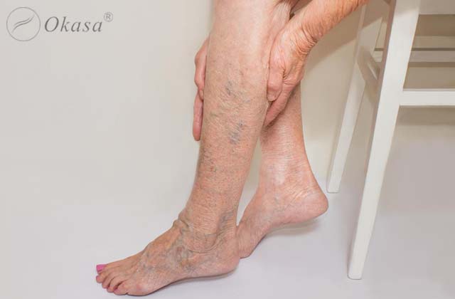 10 nguyên nhân chủ yếu gây đau chân