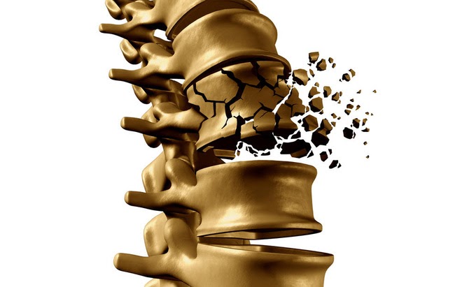 đau lưng khi nằm ngửa do loãng xương