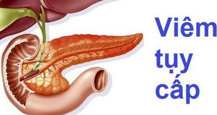 Đau sườn trái dưới tim do viêm tụy