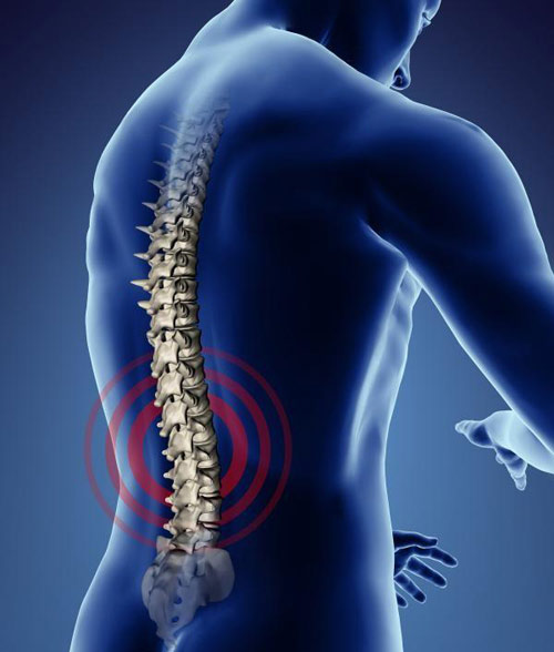 đau thắt lưng cột sống do đau thần kinh tọa