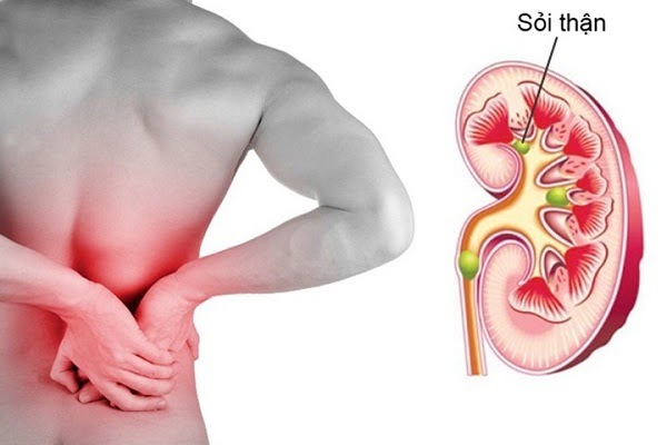 đau vùng thắt lưng là dấu hiệu của bệnh gì