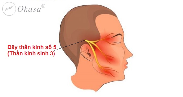 Bấm huyệt trị đau dây thần kinh số 5
