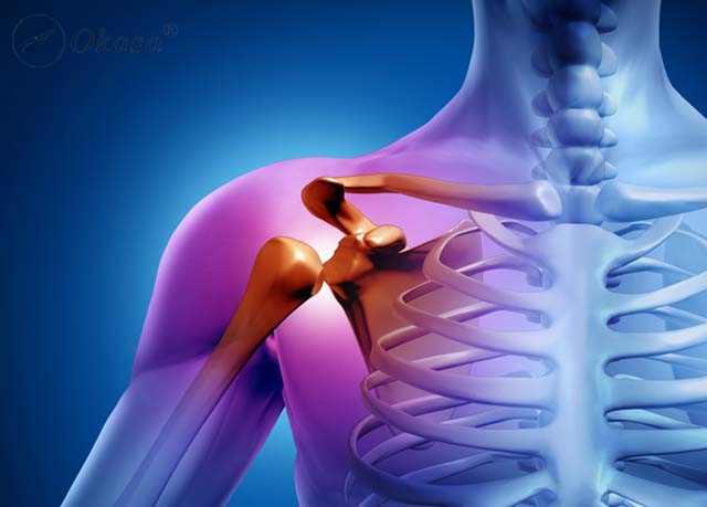 Bệnh viêm dính khớp vai: Nguyên nhân và phương pháp điều trị