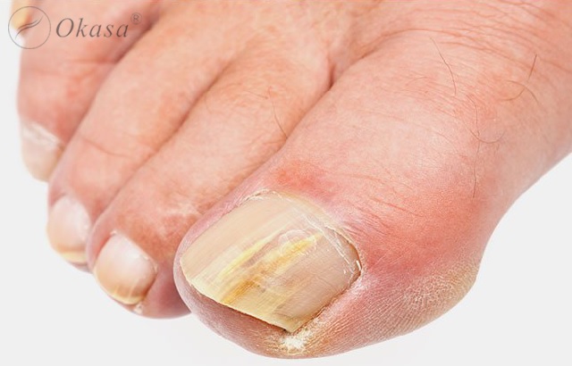 Bí quyết chăm sóc cho đôi chân của bạn