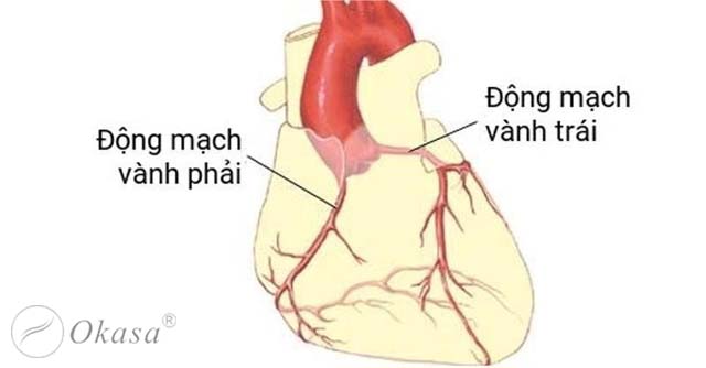 Biến chứng bệnh động mạch vành