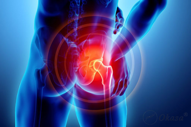 Các giai đoạn của viêm khớp háng