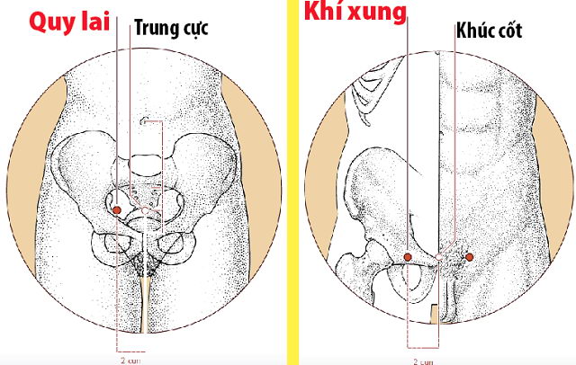Các huyệt nằm ở trên đường kinh Vị