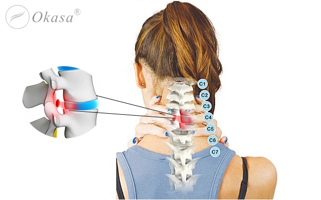 Các phương pháp điều trị thoát vị đĩa đệm cột sống cổ