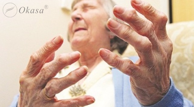 Các tính chất đặc trưng của bệnh viêm khớp dạng thấp