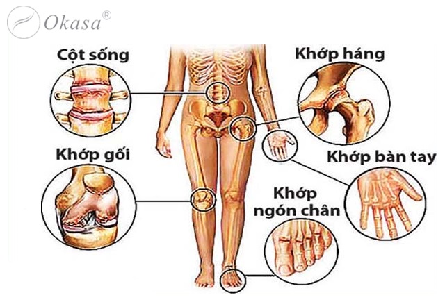 Các vị trí thoái hóa khớp và cách massage giảm đau