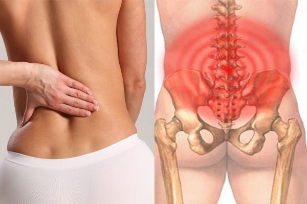 cách chữa đau lưng nhanh hiệu quả nhất