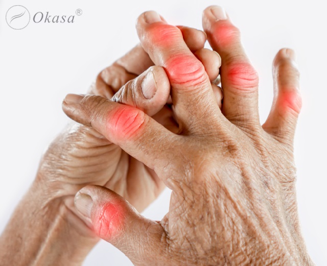 Cách giảm đau do viêm khớp dạng thấp mãn tính