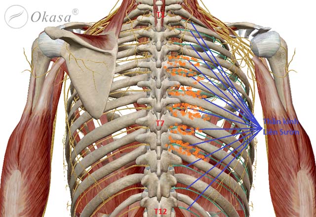 Hiểu về bệnh đau dây thần kinh liên sườn