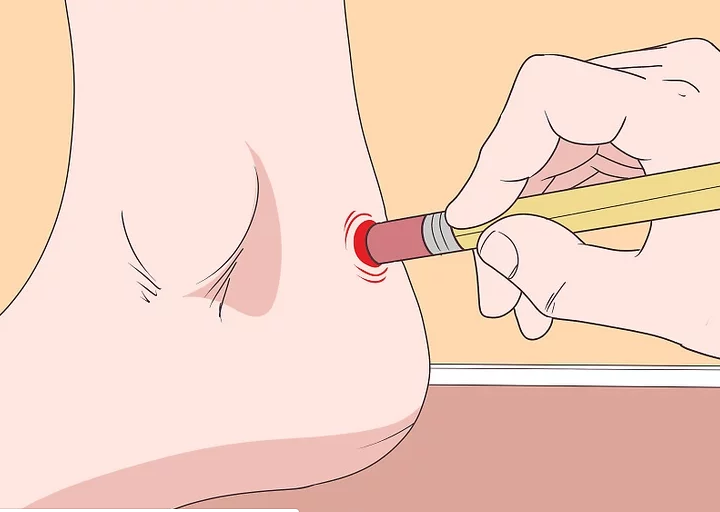 chữa đau gót chân bằng bấm huyệt hiệu quả