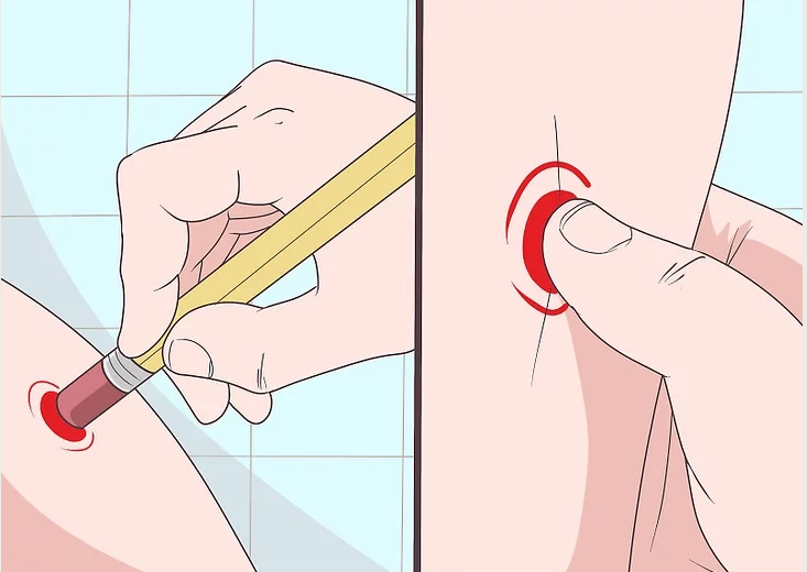 chữa đau gót chân bằng bấm huyệt