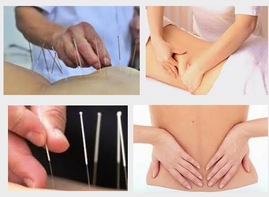 Chữa đau thắt lưng cột sống bằng châm cứu