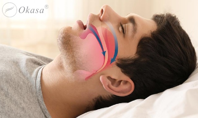 Chứng ngừng thở khi ngủ ở người thừa cân béo phì