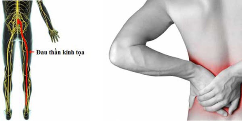 đau âm ỉ vùng thắt lưng bên trái do đâu
