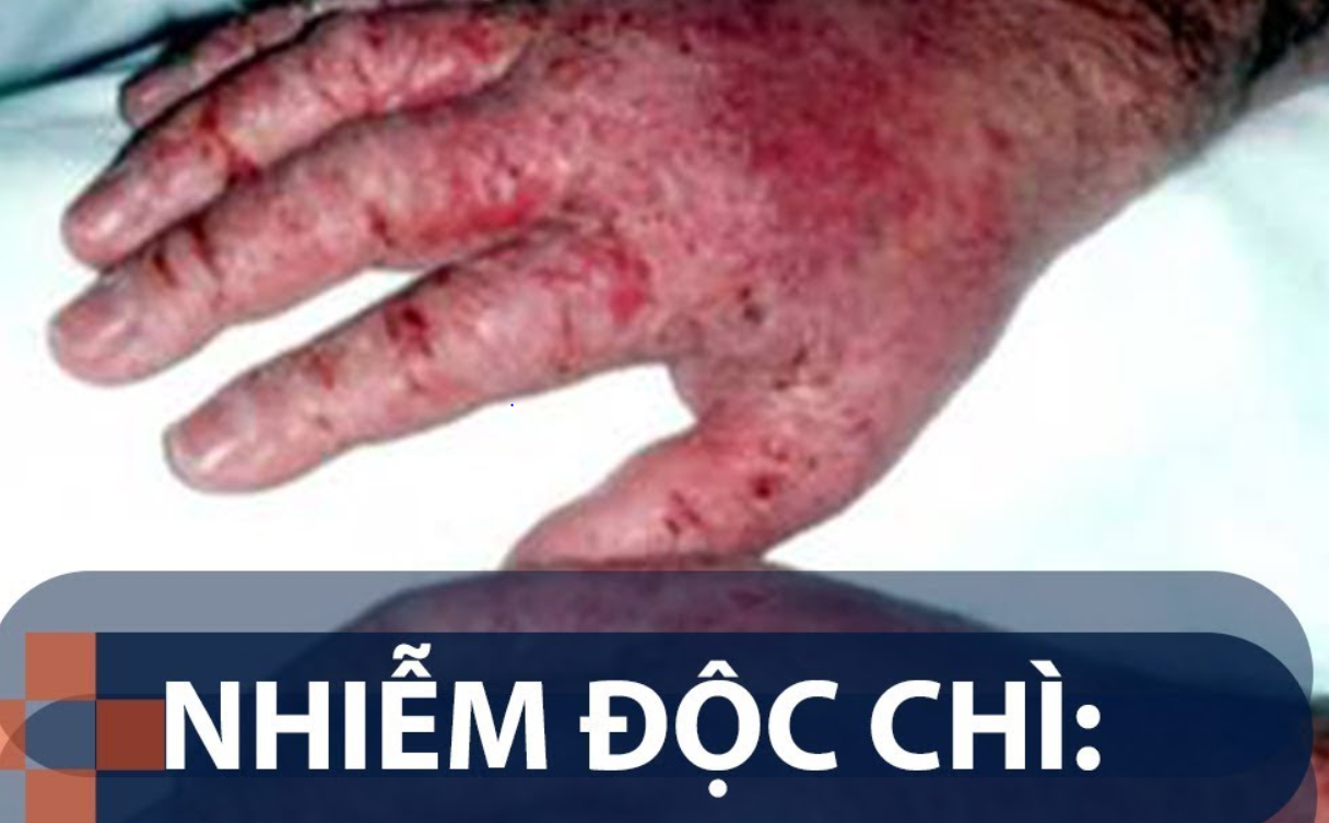 đau đầu buồn nôn lạnh người có bị làm sao không