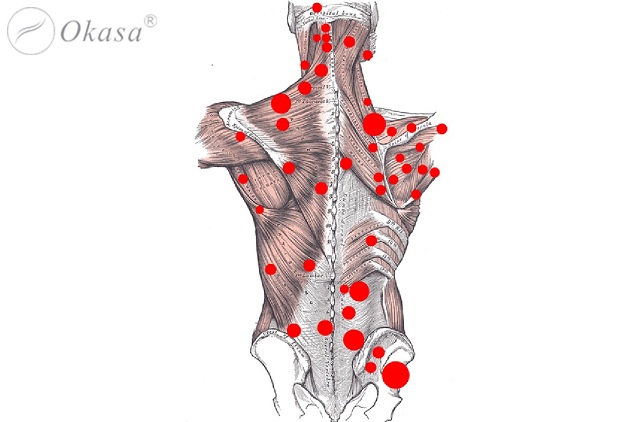 Đau nhức cơ bắp: Nguyên nhân và cách trị liệu