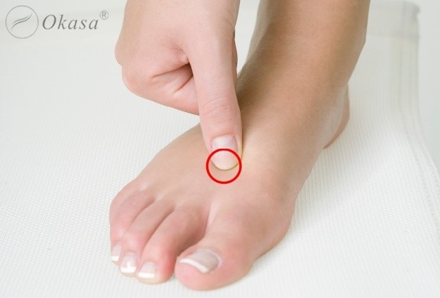 Đau nhức cơ bắp: Nguyên nhân và cách trị liệu