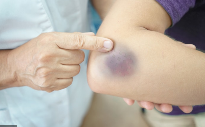 điều trị đau nhức khớp tay chân hiệu quả