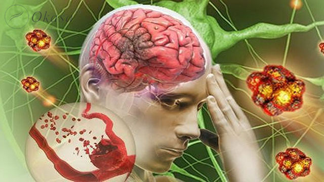 Điều trị phục hồi cho người tai biến mạch máu não