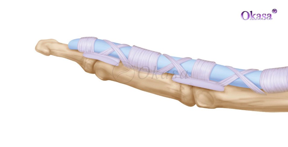 điều trị viêm bao gân ngón tay