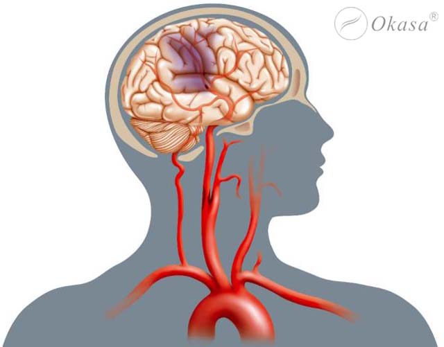 Hiểu về bệnh cao huyết áp nguyên phát