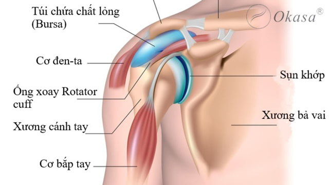 Hiểu về bệnh viêm cơ vai