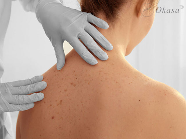 Hiểu về chứng đổ mồ hôi bất thường