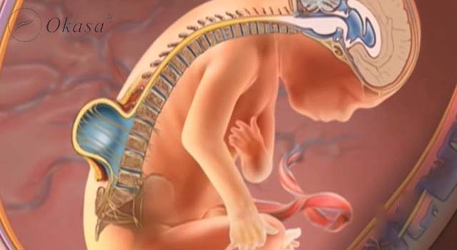 Hiểu vệ dị tật đốt sống chẻ đôi