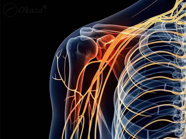 Hiểu về hội chứng bắt chẹn khớp vai mạn tính