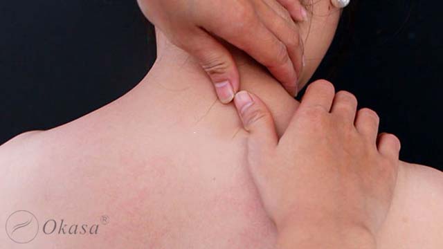 Hiểu về hội chứng bắt chẹn khớp vai mạn tính