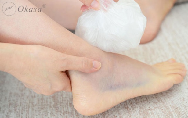 Hiểu về tình trạng bong gân bàn chân