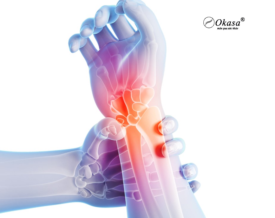 hội chứng ống cổ tay