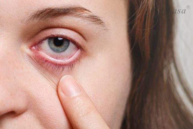 Huyết áp tăng cao gây hại cho mắt