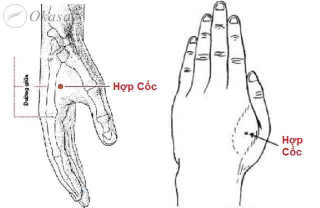 Các huyệt không dùng cho phụ nữ có thai