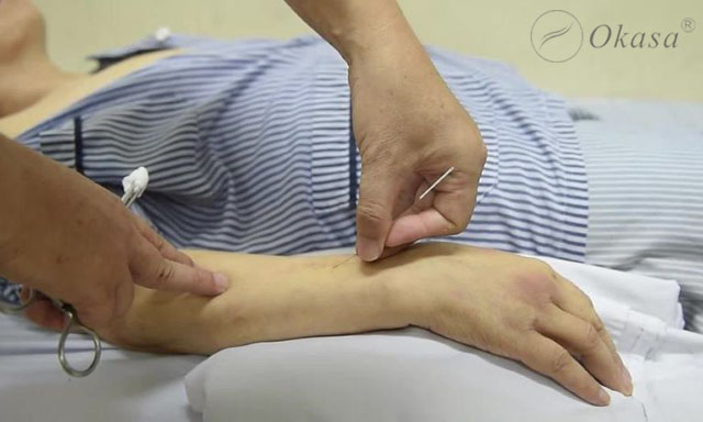 Huyệt Ngoại Quan