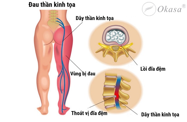 Huyệt Thừa Phù