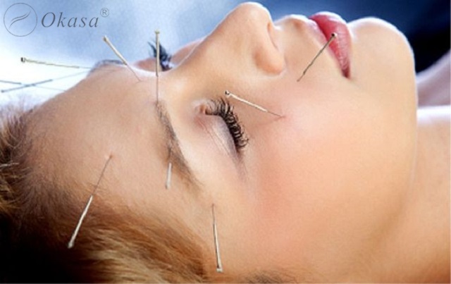 Huyệt Ty Trúc Không