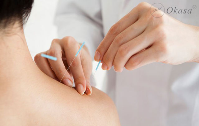 Lợi ích từ phương pháp châm cứu bấm huyệt