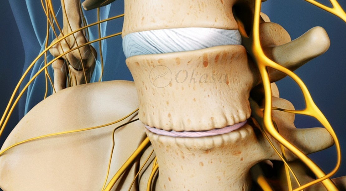 lún xẹp cột sống