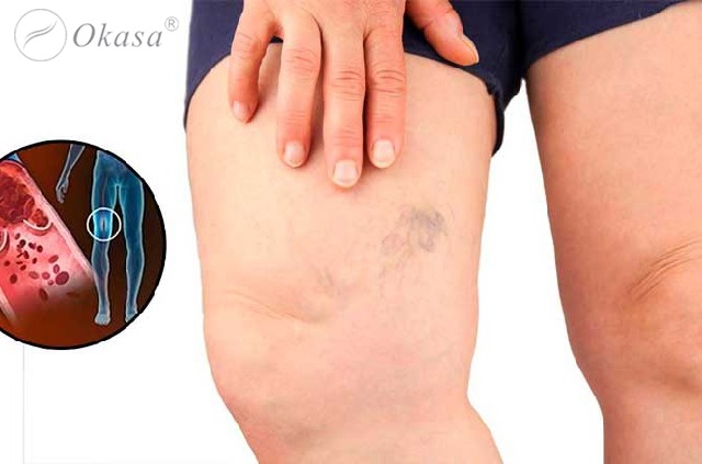 Massage chân cho bà bầu đúng cách cho hiệu quả bất ngờ