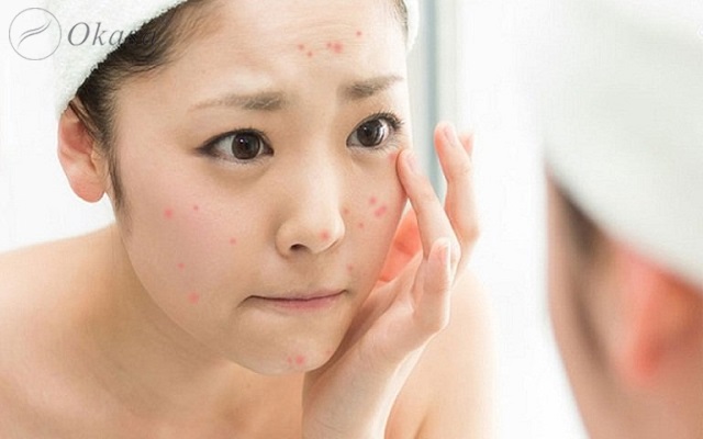 Công dụng và lợi ích của tinh dầu hoàng đàn