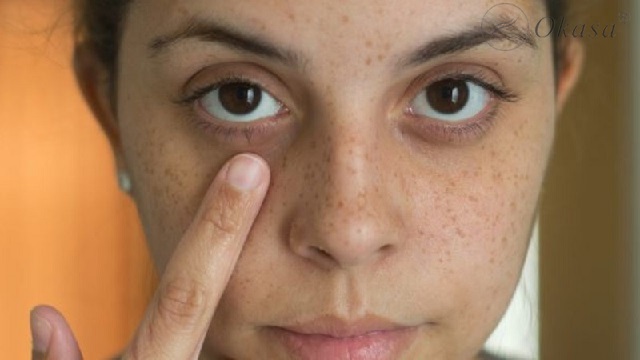 Massage giúp giảm mỏi mắt và xóa nếp nhăn