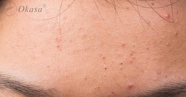 Massage mặt đúng cách ngăn ngừa lão hóa