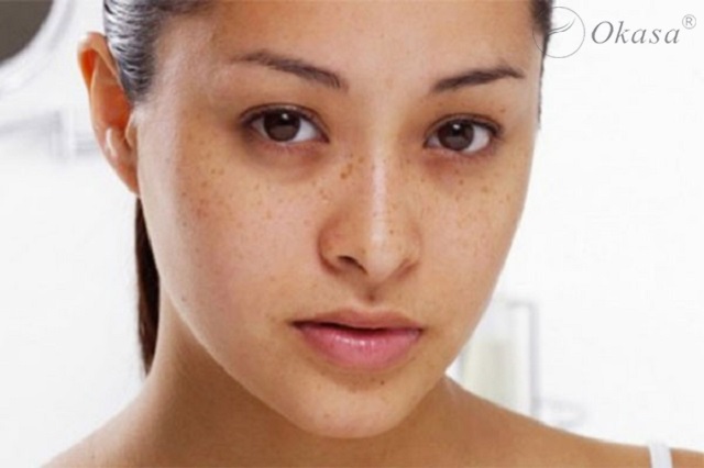 Massage mắt đúng cách sẽ giúp giảm quầng thâm hiệu quả