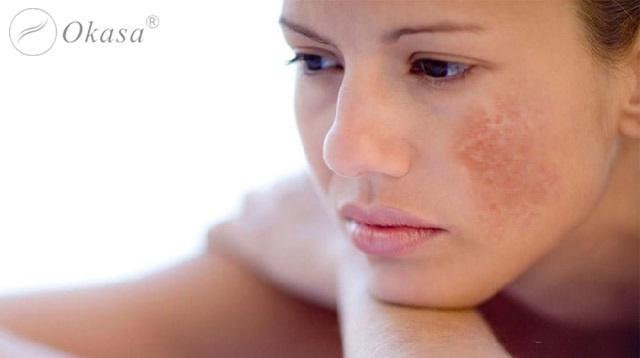 Massage mặt với dầu dừa để sở hữu làn da căng mịn và trắng hồng