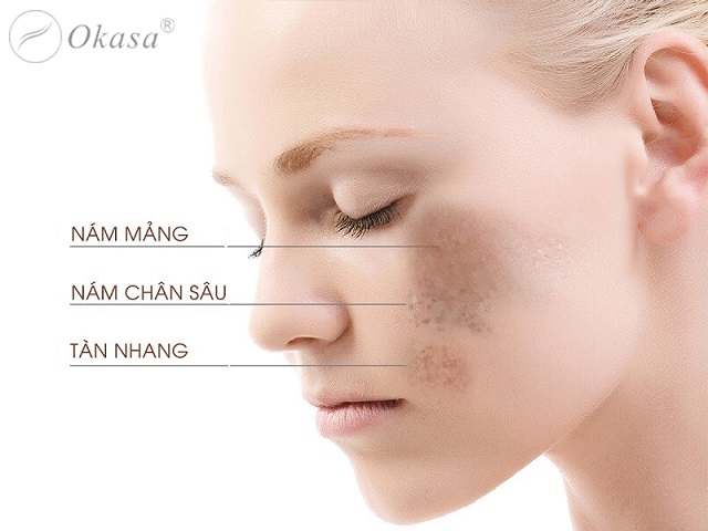 Massage mặt với dầu dừa để sở hữu làn da sáng đẹp tự nhiên